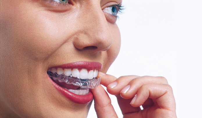 A woman putting invisalign braces in her mouth, Roseacre Cottage Dental, Maidstone