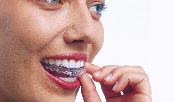 woman inserting Invisalign clear braces