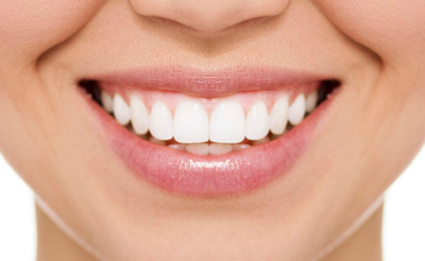 home teeth whitening