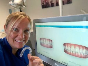 Invisalign in Maidstone, Kent