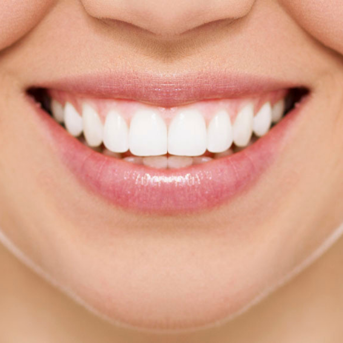 teeth whitening in Maidstone, Kent