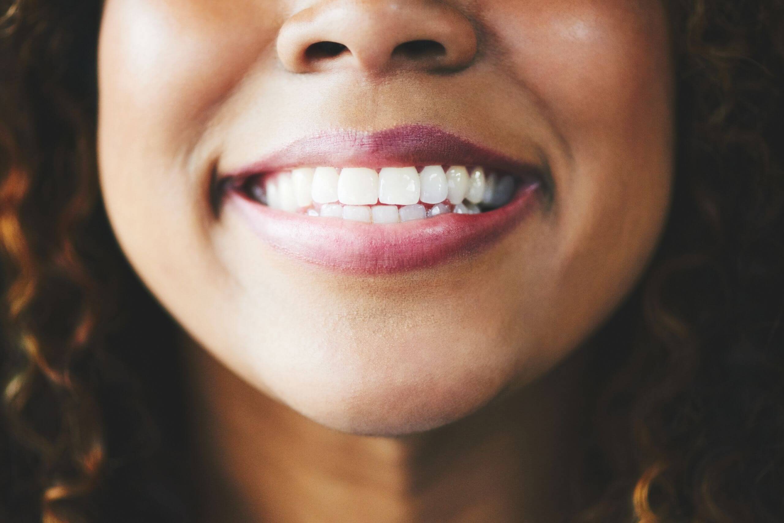 woman's white teeth