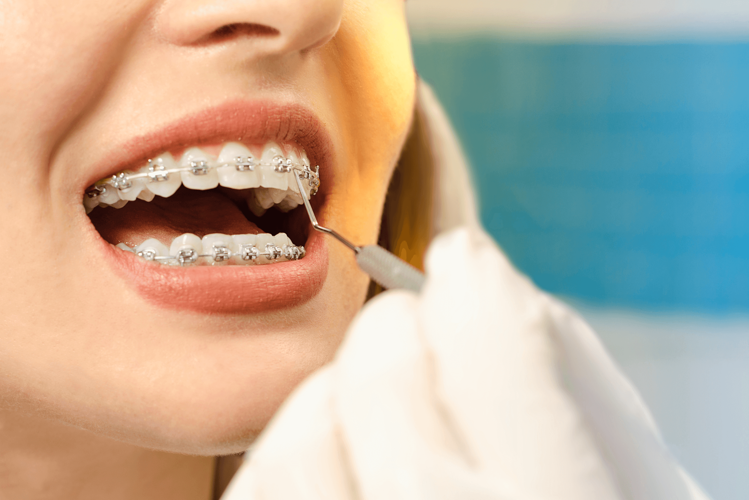 Close up of woman with braces receiving dental treatment by staff member in medical gloves