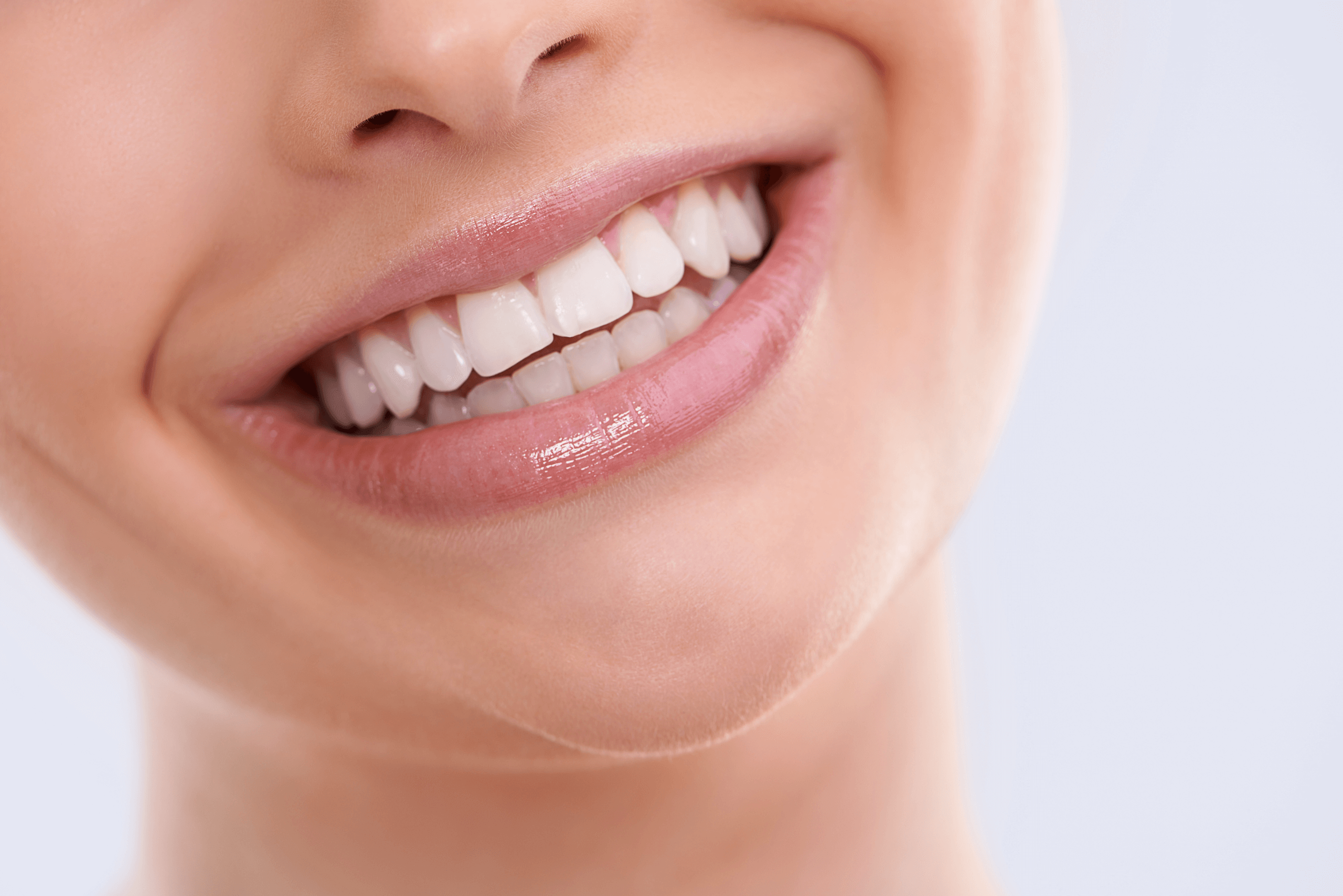White teeth Roseacre Dental