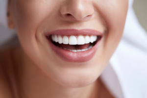 Woman with bright white and clean teeth
