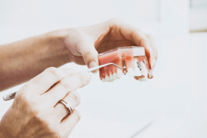 Explanation of how Dental Implants work