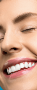 woman with whitened teeth