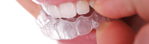 Woman putting Invisalign braces in at Maidstone, Kent