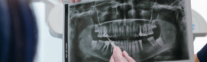 dentist at Maidstone dental practice pointing at xray