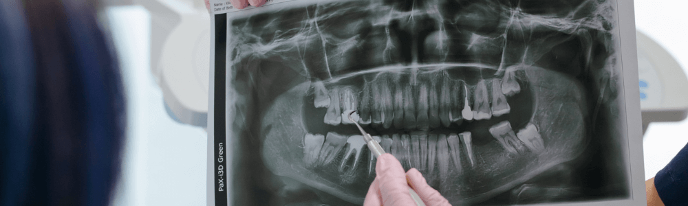 consultation for bite problems in maidstone, kent