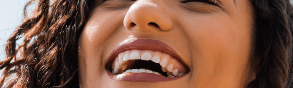 woman with six month smiles treatment in maidstone, kent