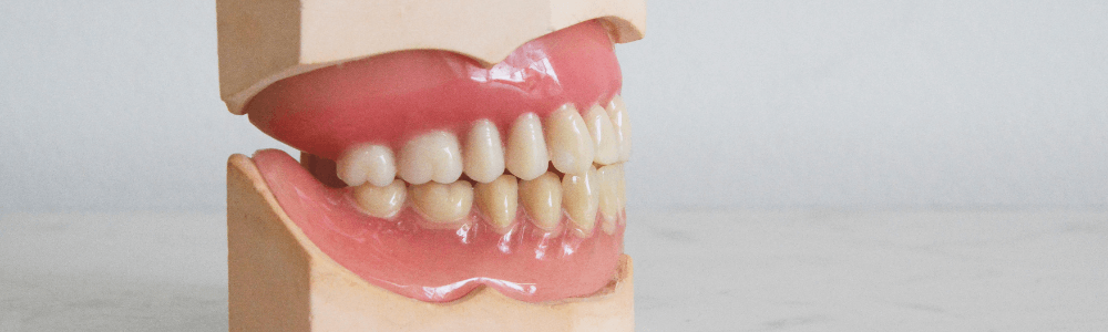 gum recession model in Maidstone, Kent